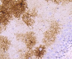 Invitrogen gamma Synuclein Recombinant Rabbit Monoclonal Antibody (JM90-32)