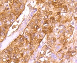 Invitrogen gamma Synuclein Recombinant Rabbit Monoclonal Antibody (JM90-32)