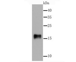 Invitrogen gamma Synuclein Recombinant Rabbit Monoclonal Antibody (JM90-32)