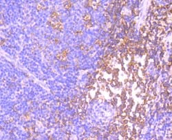 Invitrogen ID1 Recombinant Rabbit Monoclonal Antibody (JM92-13) 100 &mu;L;