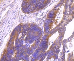 Invitrogen ID1 Recombinant Rabbit Monoclonal Antibody (JM92-13) 100 &mu;L;