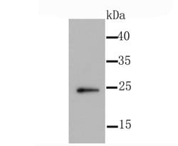 Invitrogen ID1 Recombinant Rabbit Monoclonal Antibody (JM92-13) 100 &mu;L;