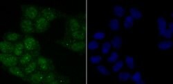 Invitrogen Phospho-ATM (Ser1981) Recombinant Rabbit Monoclonal Antibody