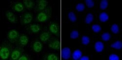 Invitrogen Phospho-ATM (Ser1981) Recombinant Rabbit Monoclonal Antibody