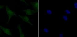 Invitrogen Phospho-ATM (Ser1981) Recombinant Rabbit Monoclonal Antibody