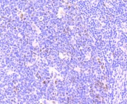 Invitrogen Phospho-ATM (Ser1981) Recombinant Rabbit Monoclonal Antibody