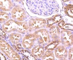 Invitrogen GABARAP/GABARAPL1 Recombinant Rabbit Monoclonal Antibody (JM30-30)