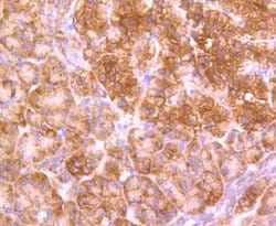 Invitrogen GABARAP/GABARAPL1 Recombinant Rabbit Monoclonal Antibody (JM30-30)