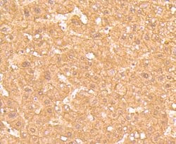 Invitrogen Ferritin Light Chain Recombinant Rabbit Monoclonal Antibody