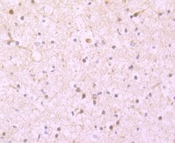 Invitrogen Ferritin Light Chain Recombinant Rabbit Monoclonal Antibody