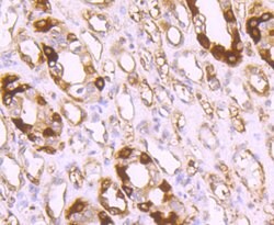 Invitrogen Ferritin Light Chain Recombinant Rabbit Monoclonal Antibody