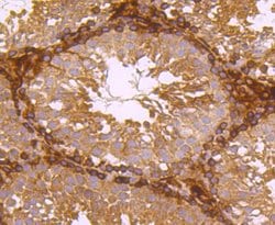 Invitrogen Ferritin Light Chain Recombinant Rabbit Monoclonal Antibody