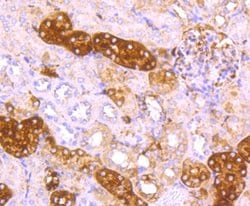 Invitrogen Ferritin Light Chain Recombinant Rabbit Monoclonal Antibody