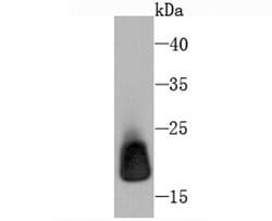 Invitrogen Ferritin Light Chain Recombinant Rabbit Monoclonal Antibody