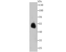 Invitrogen ENO1 Recombinant Rabbit Monoclonal Antibody (JM63-53) 100 &mu;L;