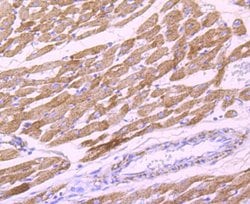 Invitrogen PDHB Recombinant Rabbit Monoclonal Antibody (JM66-33) 100 &mu;L;