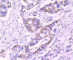 Invitrogen PDHB Recombinant Rabbit Monoclonal Antibody (JM66-33) 100 &mu;L;