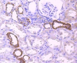 Invitrogen PDHB Recombinant Rabbit Monoclonal Antibody (JM66-33) 100 &mu;L;