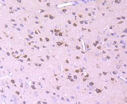 Invitrogen PDHB Recombinant Rabbit Monoclonal Antibody (JM66-33) 100 &mu;L;