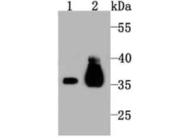 Invitrogen PDHB Recombinant Rabbit Monoclonal Antibody (JM66-33) 100 &mu;L;