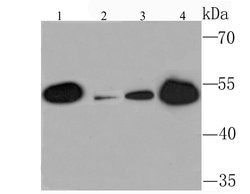 Invitrogen SETD8 Recombinant Rabbit Monoclonal Antibody (JM73-43) 100 &mu;L;