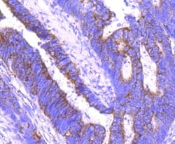 Invitrogen Angiopoietin 2 Recombinant Rabbit Monoclonal Antibody (JM71-34)