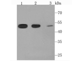 Invitrogen Angiopoietin 2 Recombinant Rabbit Monoclonal Antibody (JM71-34)