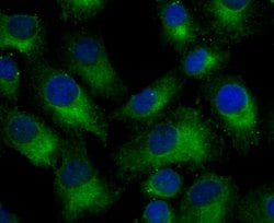 Invitrogen Nogo-B Recombinant Rabbit Monoclonal Antibody (JM02-34) 100