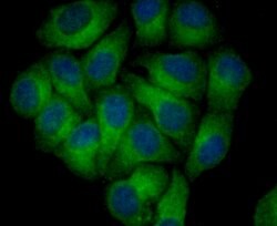 Invitrogen Nogo-B Recombinant Rabbit Monoclonal Antibody (JM02-34) 100