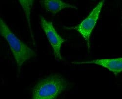 Invitrogen Nogo-B Recombinant Rabbit Monoclonal Antibody (JM02-34) 100