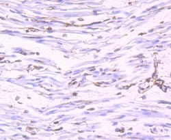Invitrogen Nogo-B Recombinant Rabbit Monoclonal Antibody (JM02-34) 100