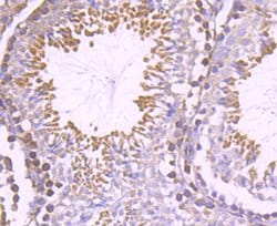 Invitrogen Nogo-B Recombinant Rabbit Monoclonal Antibody (JM02-34) 100