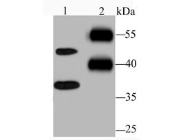 Invitrogen Nogo-B Recombinant Rabbit Monoclonal Antibody (JM02-34) 100