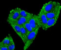 Invitrogen TFAM Recombinant Rabbit Monoclonal Antibody (JM32-44) 100 &mu;L;