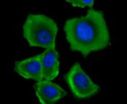 Invitrogen TFAM Recombinant Rabbit Monoclonal Antibody (JM32-44) 100 &mu;L;