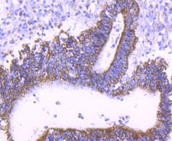 Invitrogen TFAM Recombinant Rabbit Monoclonal Antibody (JM32-44) 100 &mu;L;