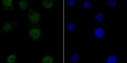 Invitrogen PFKFB3 Recombinant Rabbit Monoclonal Antibody (JM43-43) 100