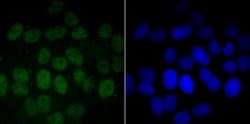 Invitrogen PFKFB3 Recombinant Rabbit Monoclonal Antibody (JM43-43) 100