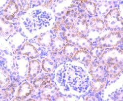 Invitrogen PFKFB3 Recombinant Rabbit Monoclonal Antibody (JM43-43) 100