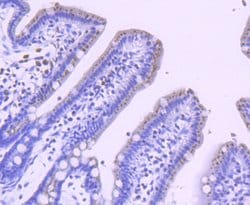Invitrogen PFKFB3 Recombinant Rabbit Monoclonal Antibody (JM43-43) 100