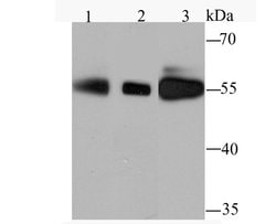 Invitrogen PFKFB3 Recombinant Rabbit Monoclonal Antibody (JM43-43) 100