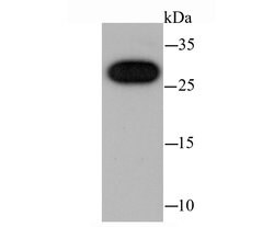 Invitrogen CBX7 Recombinant Rabbit Monoclonal Antibody (JM44-63) 100 &mu;L;