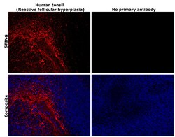 Invitrogen STING Recombinant Rabbit Monoclonal Antibody (JM03-47) 100 &mu;L;
