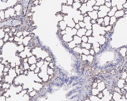 Invitrogen STING Recombinant Rabbit Monoclonal Antibody (JM03-47) 100 &mu;L;