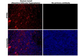 Invitrogen STING Recombinant Rabbit Monoclonal Antibody (JM03-47) 100 &mu;L;