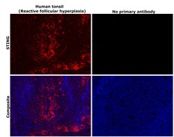 Invitrogen STING Recombinant Rabbit Monoclonal Antibody (JM03-47) 100 &mu;L;