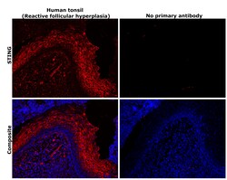 Invitrogen STING Recombinant Rabbit Monoclonal Antibody (JM03-47) 100 &mu;L;