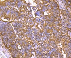 Invitrogen Cyclophilin F Recombinant Rabbit Monoclonal Antibody (JM71-39) 100 &mu;L | Buy Online | Invitrogen&trade; | Fisher Scientific