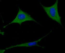 Invitrogen TXNIP Recombinant Rabbit Monoclonal Antibody (JM60-35) 100 &mu;L;