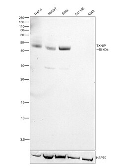 Invitrogen TXNIP Recombinant Rabbit Monoclonal Antibody (JM60-35) 100 &mu;L;